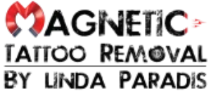 Agnetic Tattoo Removal